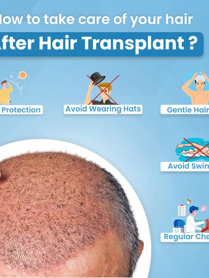 Proper post-transplant care is crucial. This graphic outlines key steps like sun protection, gentle washing, and avoiding hats to ensure your new hair grows strong.