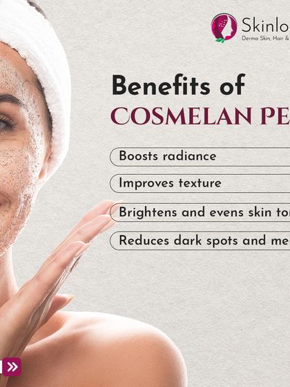 This graphic outlines the key benefits of a Cosmelan Peel, a professional depigmenting treatment. It highlights how the peel boosts radiance, improves texture, brightens skin tone, and reduces dark spots and melasma.
