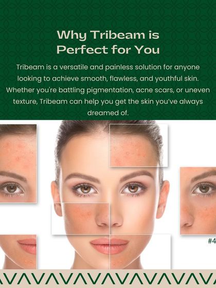 Sree Vasavi - Pigmentation & Skin Brightening Advanced Laser for Pigmentation & Scars photo 11