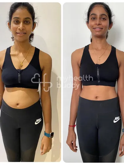 A front view of Logeswary's journey. She broke the myth that you can't lose belly fat and proved that a targeted approach works.