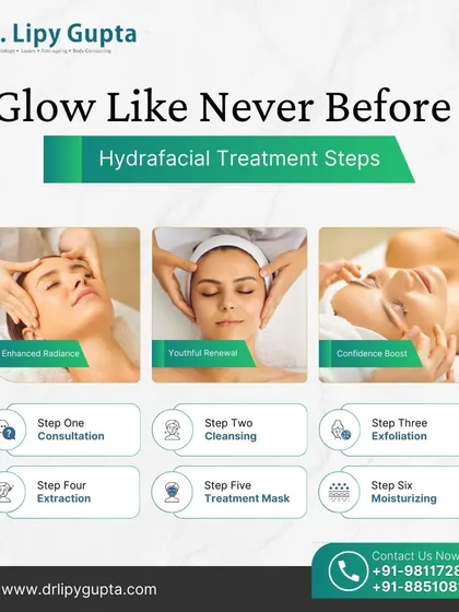 Here are the six essential steps of my HydraFacial treatment, from the initial consultation to the final moisturizing step. Each stage, including cleansing, exfoliation, and extraction, is designed to work together to deliver enhanced radiance and a youthful renewal for a major confidence boost.