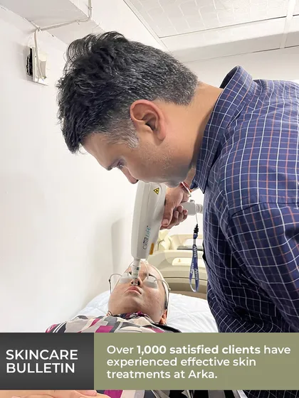 Here you can see a laser skin treatment in progress at my clinic. I personally supervise procedures to ensure they are performed with the highest standards of safety and precision, using only US FDA-approved technology for reliable and effective outcomes.