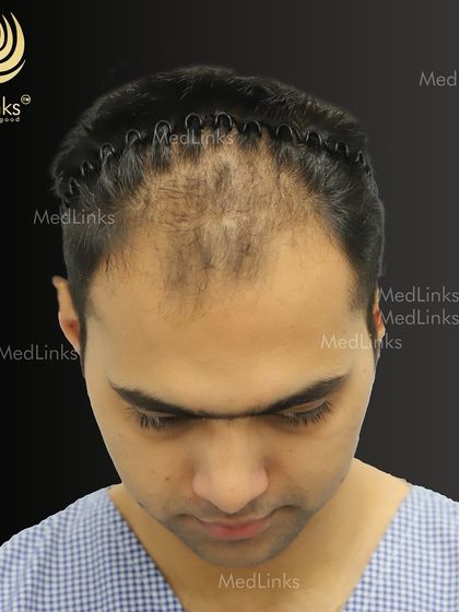 A top-down view during the preparation phase. This meticulous process is part of our commitment to achieving exceptional outcomes for every person who trusts us with their hair.