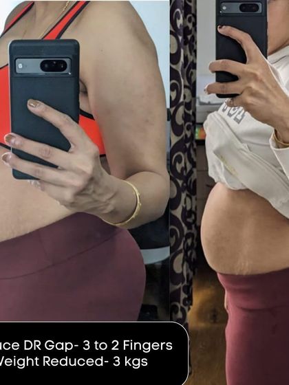 This client reduced her DR gap from 3 to 2 fingers and lost 3kg, demonstrating consistent healing and progress.