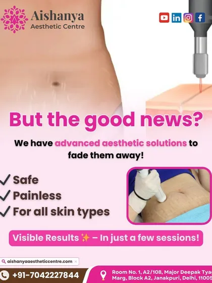 Stretch marks are a form of scarring, and the good news is that we have advanced aesthetic solutions to fade them. This graphic highlights that my treatments are safe, painless, and suitable for all skin types.