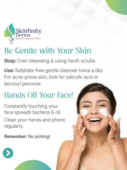 More expert advice from the Times of India feature: be gentle with your skin, use a sulphate-free cleanser, and keep your hands off your face to prevent spreading bacteria.