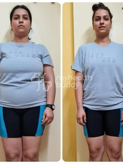 Shipra's 14 kg weight loss over 6 months is a testament to her dedication. Her journey highlights how a personalized plan and consistent support can lead to not just physical changes but a complete mindset transformation.