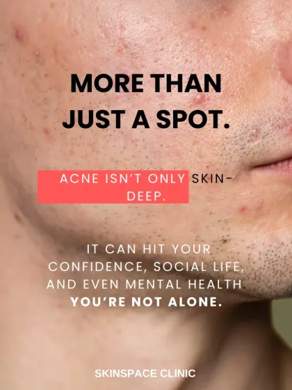 I understand that acne is more than skin deep. It can significantly impact confidence and mental health, which is why I offer compassionate care and effective solutions. You are not alone in this journey.