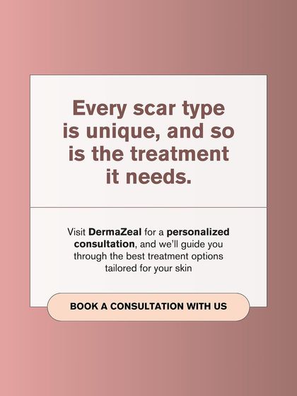 Every scar type is unique and needs a tailored treatment plan. A personalized consultation is the only way to determine the best approach for your skin.