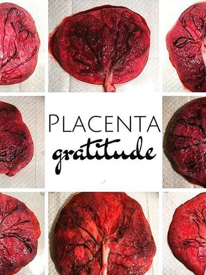 Pujitha Shetty - Prenatal and Postnatal Fitness Classes Understanding Your Pregnant Body photo 3