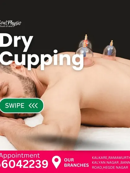 Dry cupping is an ancient therapy that we use to help with pain, inflammation, and blood flow. The suction helps relieve muscle tension and promote cell repair.