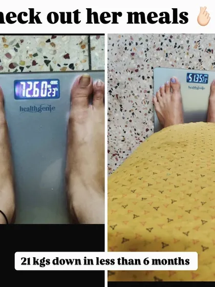 21 kgs down in less than 6 months. This incredible transformation from 72.6 kg to 51.3 kg was achieved through our ultimate gold plan, proving that sustainable results are possible.