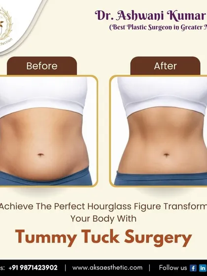 A tummy tuck is more than just fat removal; it's about restoring the shape of your abdomen. This visual demonstrates the goal of the procedure: to remove loose skin and tighten the underlying muscles, creating a smoother and firmer stomach, often desired after pregnancy or significant weight loss.