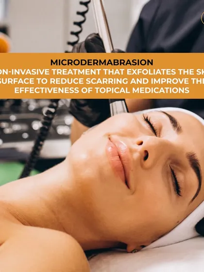 Microdermabrasion is a non-invasive treatment that gently exfoliates the skin's surface. This process helps to reduce scarring, improve the effectiveness of topical medications, and reveal a smoother, more refreshed skin texture.