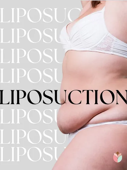 Liposuction is a targeted procedure for removing stubborn pockets of fat that don't respond to a healthy lifestyle. It is not a weight-loss tool but a powerful body sculpting technique to help you achieve a smoother and more defined body shape.