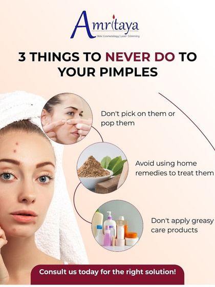 Here are three things you should never do to your pimples: don't pick them, avoid unverified home remedies, and do not use greasy products. For the right solution, it is always best to consult an expert.