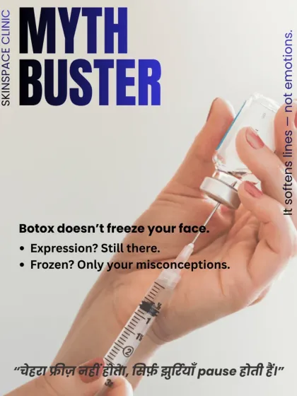 Let's bust a major myth: Botox does not freeze your face. When administered correctly by a trained dermatologist, it simply softens the lines caused by muscle movement, not your emotions. Your expressions remain, but the wrinkles are paused.