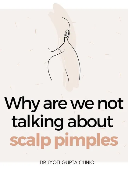 Scalp pimples can be painful and affect self-esteem. I outline a comprehensive treatment plan that includes lifestyle changes, proper hair styling habits, and specific shampoos to manage this common condition.