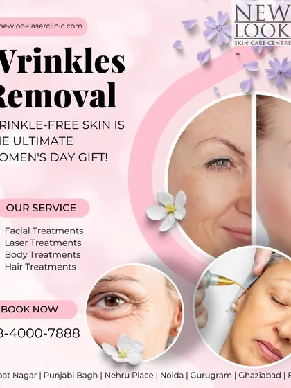 A clear look at the results of our targeted wrinkle removal treatments. We focus on smoothing fine lines and deeper wrinkles to restore a naturally youthful and rested appearance, as seen in this before-and-after comparison.