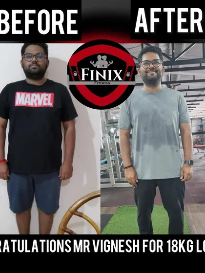 A huge congratulations to Vignesh for his incredible 18 kg weight loss. This before and after photo is a testament to his hard work and the effectiveness of a personalized nutrition plan that fits into a busy lifestyle.