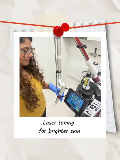 Here I am performing a laser toning session, one of the most effective ways to achieve brighter, more even-toned skin. This Q-switched laser treatment is excellent for reducing pigmentation and giving the skin an instant, healthy radiance with no downtime.