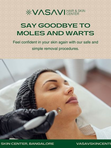 Sree Vasavi - Wart, Skin Tag & Keloid Removal Expert Wart and Mole Removal photo 3