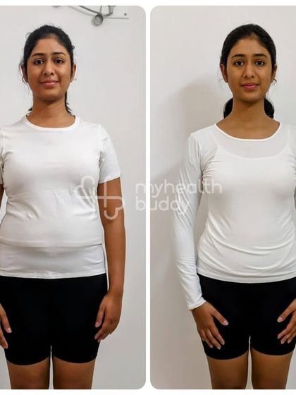 Front view of Dipanwita's 10kg transformation.