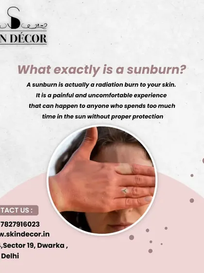 A sunburn is more than just redness; it is a radiation burn to your skin from UV exposure. It is a painful sign of skin damage that can lead to long-term issues like pigmentation and premature aging. Proper protection is key to prevention.