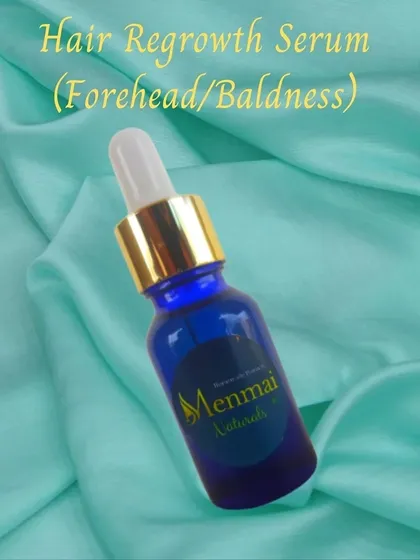 This is my Hair Regrowth Serum, which I created specifically for stubborn areas like a thinning forehead hairline or patches of baldness. It is a concentrated blend with ingredients like onion, ginger, and rosemary oil to stimulate the scalp.