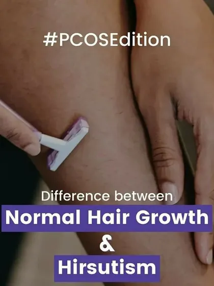 An introductory visual discussing the difference between normal hair growth and hirsutism in the context of PCOS.