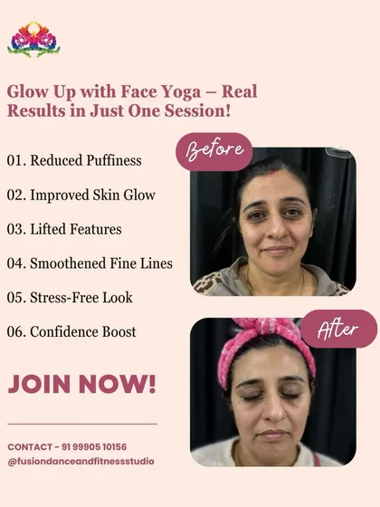 Real results in just one session! This before-and-after from our Face Yoga workshop shows a visible reduction in puffiness and an improved skin glow.