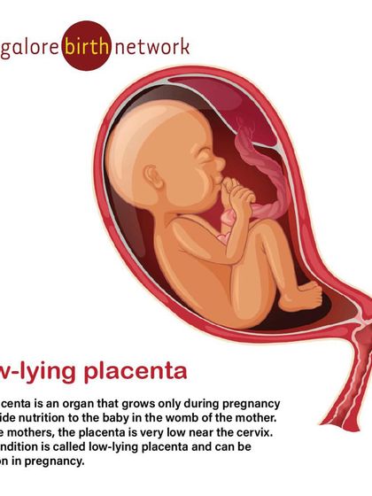 A low-lying placenta is a common condition where the placenta is close to the cervix. We explain what this means, how it's monitored, and why it often resolves on its own as the uterus grows.