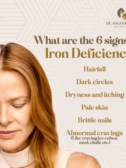 Nutritional deficiencies, particularly low iron, are a frequent and often overlooked cause of significant hair fall. This infographic highlights the key signs of iron deficiency, emphasizing the importance of a holistic diagnosis that includes assessing your internal health.