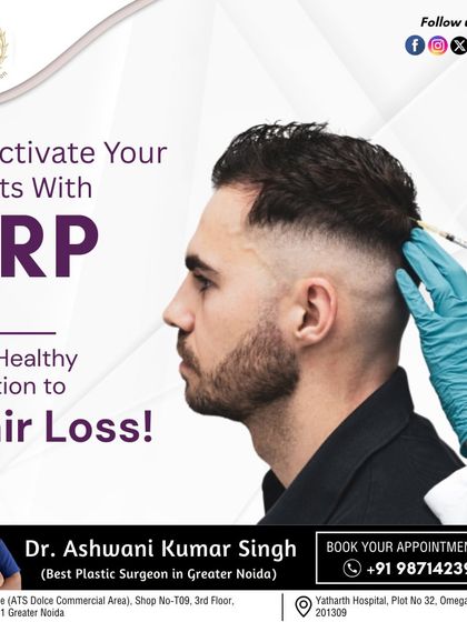 This image shows a patient undergoing PRP injections along the hairline. This targeted approach helps reactivate the roots in areas where thinning is most prominent, offering a healthy solution to hair loss.