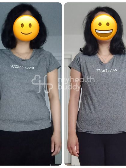 A front view of the same 7kg transformation, showing a clear change in body composition and a healthier look.