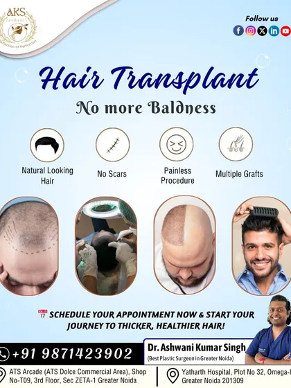 This provides a quick summary of what you can expect from my hair transplant service. I focus on creating a natural look with a painless procedure that leaves no scars, using multiple grafts to achieve the desired density.