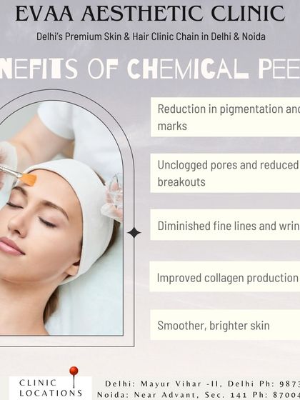 A summary of the benefits of chemical peels, such as reduction in pigmentation, unclogged pores, diminished fine lines, and improved collagen production.