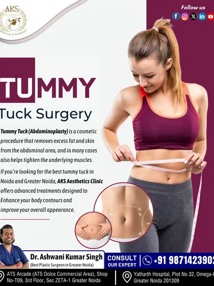 A tummy tuck, or abdominoplasty, is a procedure to address excess skin and fat, often after pregnancy or significant weight loss. It also involves tightening the underlying abdominal muscles that may have separated, creating a firmer and more contoured core.