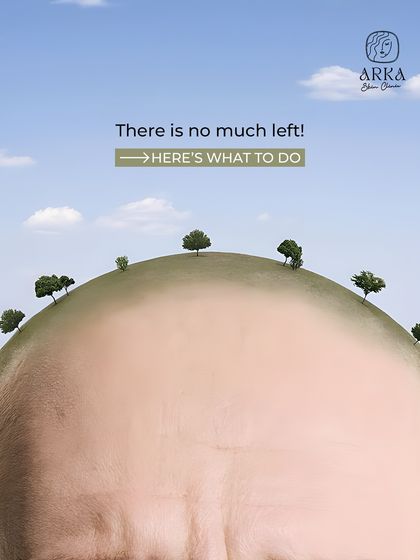 Once you have your new hair, you need to take care of it. This image introduces our essential post-transplant care guide to ensure your investment lasts a lifetime.