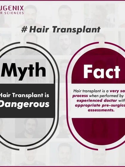 We tackle the biggest myths head-on: hair transplants are painful, only for celebrities, look fake, are dangerous, or are better done abroad.