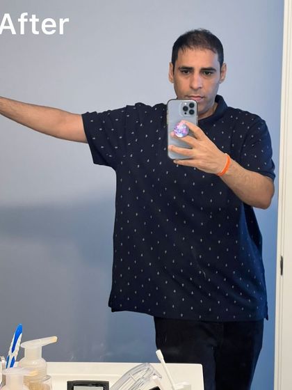 The 'after' shot. A testament to his incredible discipline with no cheat meals and daily check-ins, achieving this transformation without ever stepping into a gym before.