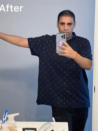 The 'after' shot. A testament to his incredible discipline with no cheat meals and daily check-ins, achieving this transformation without ever stepping into a gym before.