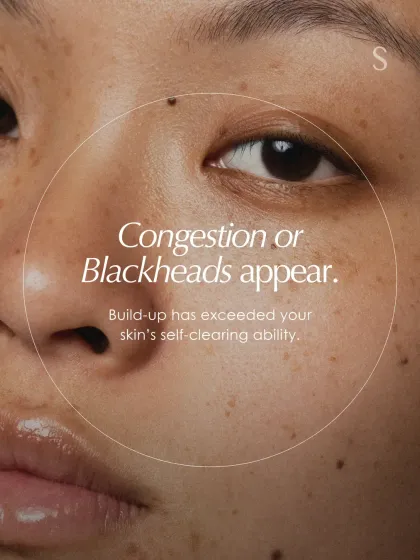 When congestion or blackheads appear, it means buildup has exceeded your skin's self-clearing ability. A professional facial can help reset this balance.