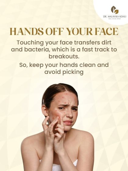 A fundamental principle of skin hygiene is to avoid touching your face. Hands transfer dirt, oil, and bacteria, which are primary triggers for breakouts and clogged pores. This simple habit change is a critical step in any acne management plan.