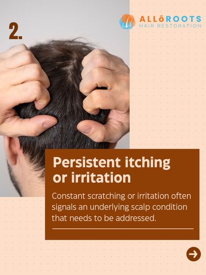 Persistent itching or irritation is a clear signal of an underlying scalp condition. Constant scratching should not be ignored and needs to be addressed by a professional.