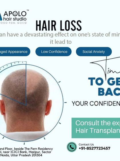Hair loss can negatively affect your state of mind, leading to an aged appearance, low confidence, and social anxiety. It's time to get your confidence back by consulting with a hair transplant expert.