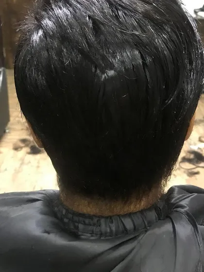This is the 'after' result for the client in the previous image. A full head of hair has been restored using a hair patch, which has been cut and styled into a modern, textured look.