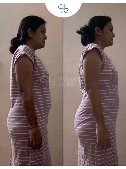 Side view of Sampada's 5kg weight loss.