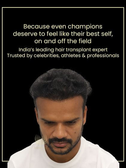 Even champions deserve to feel their best. Lalit's final result shows a full head of hair that matches his powerful presence on and off the field.
