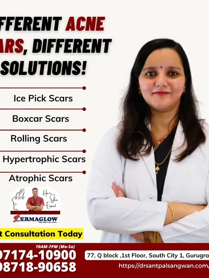 I understand that not all acne scars are the same. This graphic outlines the different types of scars we treat, including ice pick, boxcar, rolling, hypertrophic, and atrophic scars. My approach is to first identify your specific scar type to create a targeted and effective treatment plan.